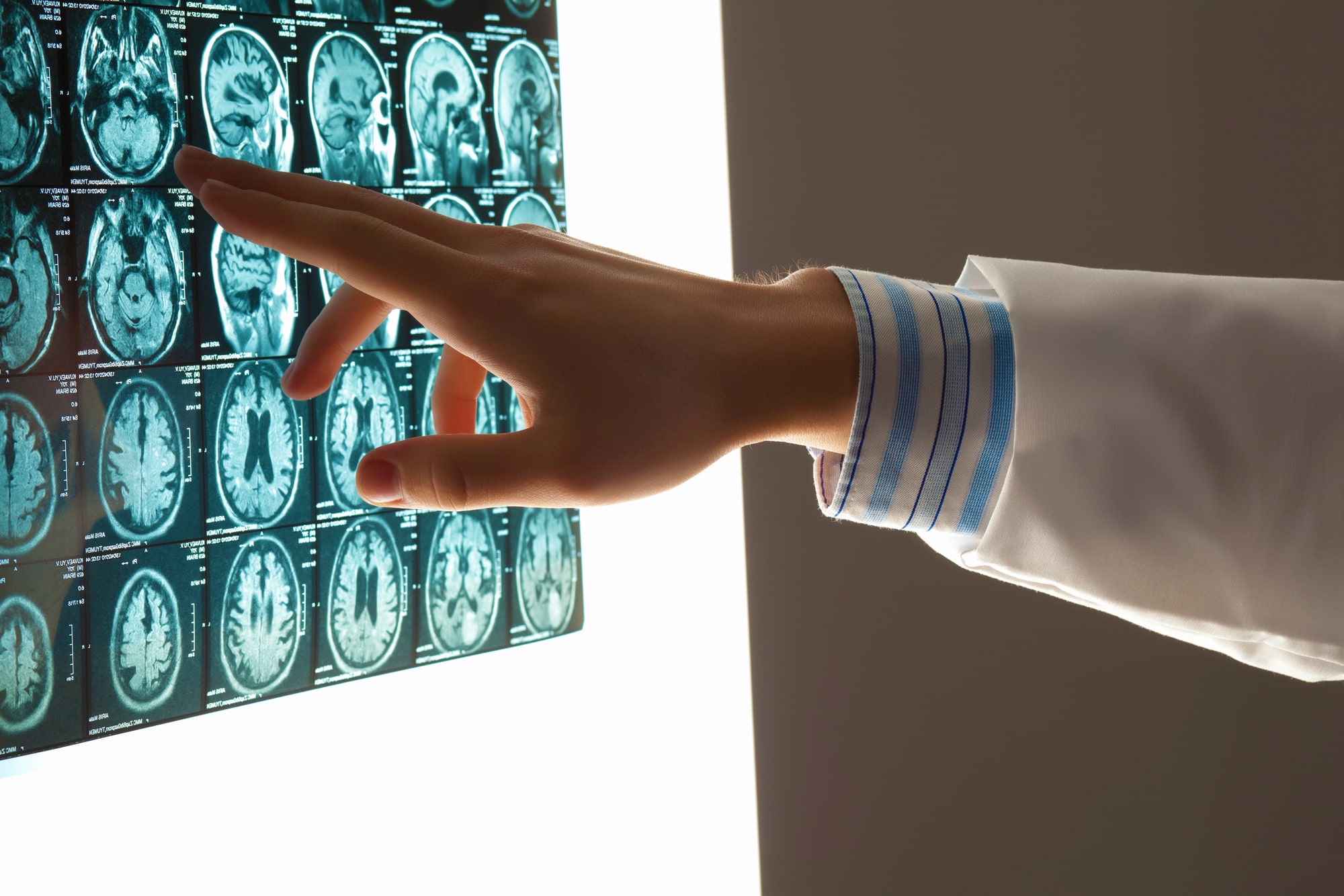 TBI lawyer in Hollywood, FL
